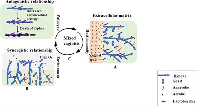 Frontiers | Recent Advances in Presentation, Diagnosis and